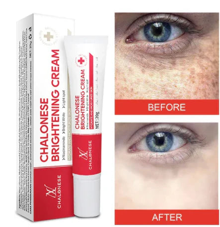 Chalonese brightening cream