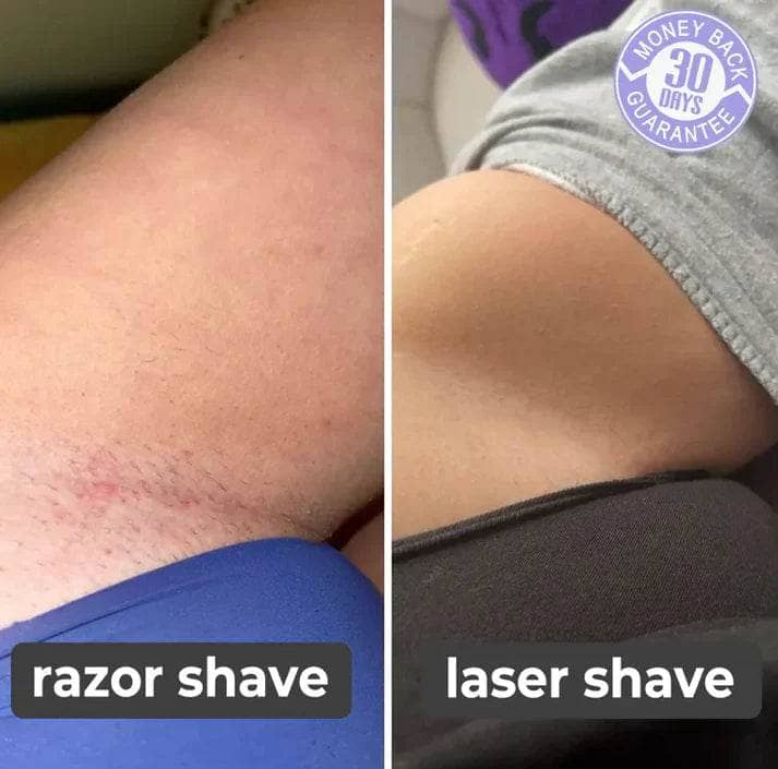 Pain Free Hair Remover Rechargeable Device